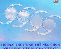 MỔ ĐỤC THỦY TINH THỂ NÊN CHỌN NHÂN ĐƠN TIÊU HAY ĐA TIÊU CỰ